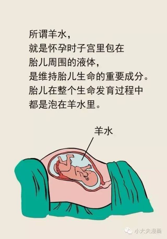 夺命的羊水栓塞是怎么回事?