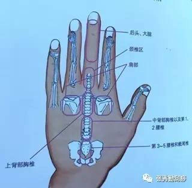 第三掌骨 手背以中指第三掌骨为中心的缩影,中指靠近第三掌骨处的指