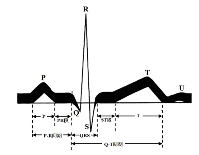 好朋友心电图机家用100法:测出t波异常怎么办?