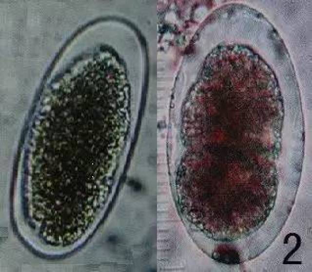 广州管圆线虫卵