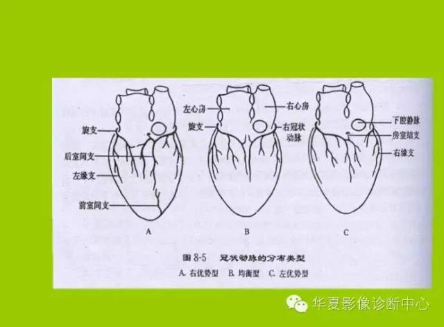 冠状动脉解剖,分段及基本疾病诊断