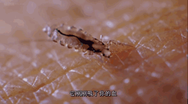 有一种虱子叫阴虱,生活在人体不可描述部位的毛发上,长得像螃蟹,所以