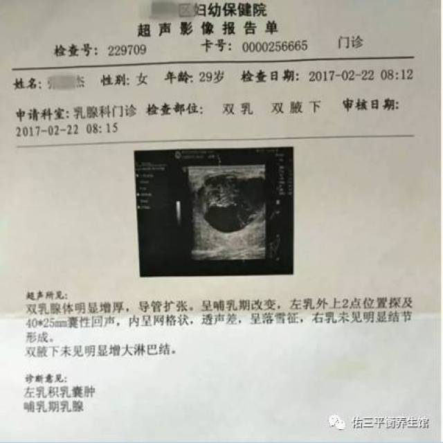 上保险乳腺囊肿需要告知吗 乳腺囊肿买不了商业保险