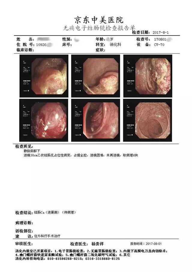 昨天我们在文中写道一16岁患者被查出患有结肠息肉病,然而在接下来的