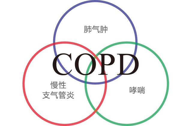 最新研究 绿茶能预防和缓解因吸烟引起的copd