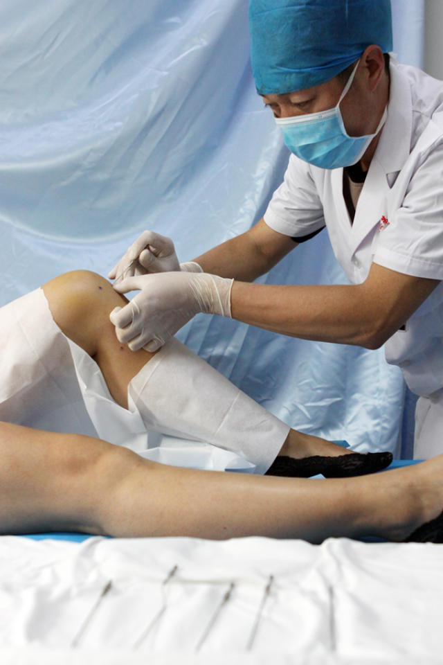 医生运用古九针疗法为患者治疗膝关节疼痛.