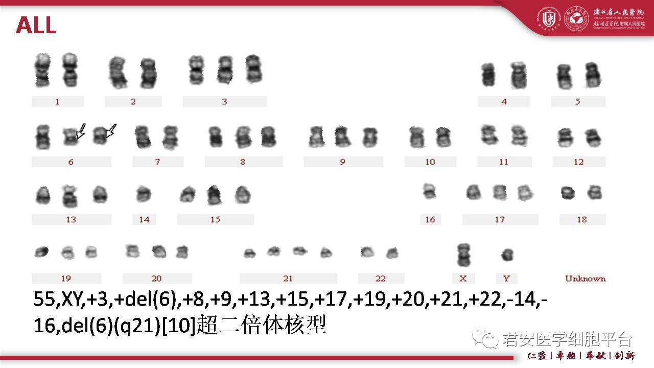 染色体核型分析在临床中的应用--第六阶段第14期-a(总166期)2017.4.24