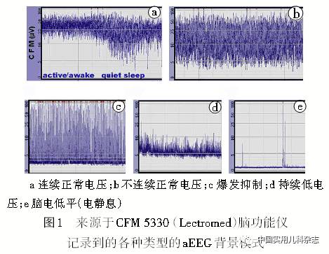 专题笔谈│振幅整合脑电图在新生儿重症监护病房的应用