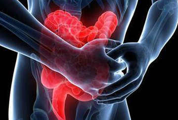 炎症性肠病的治疗要取决于多个因素,其中包括病变部位(回,结肠或结肠