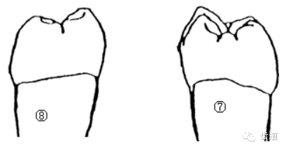 (六)下颌第一磨牙和下颌第二磨牙的鉴别