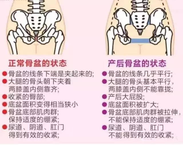 新|9.9元骨盆修复亲情推送!养护女人生命之根从星妈咪开始!