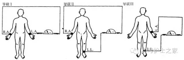 教你学做心电图