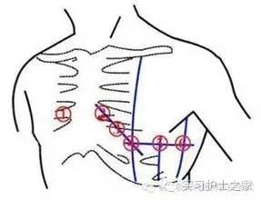 十二导联心电图分别接在什么位置       红黄黑绿分别夹在右腕,左腕