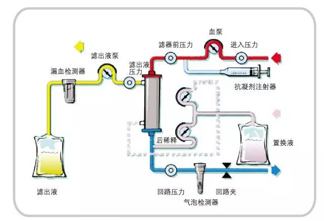 科技 正文  没啥合适的图o(╯□╰)o 血液透析滤过 事实上这就是将