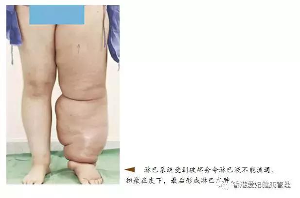 几个告别大象腿的经典之选(生活之美容塑身)