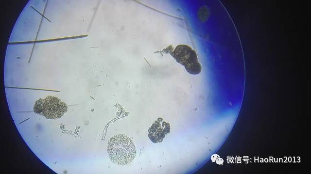 5月1日大量微囊藻,螺旋藻,席藻等蓝藻处理前显微镜检测情况:5月1日