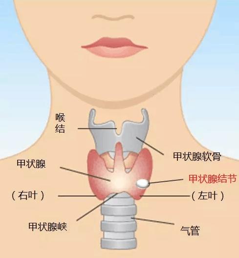 乳腺增生穿什么内衣好_单侧乳腺增生图片(3)