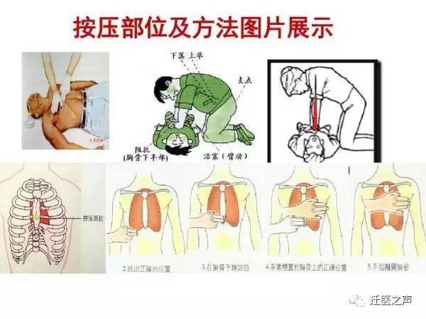 【心肺复苏】时间就是生命,抢救永不言输