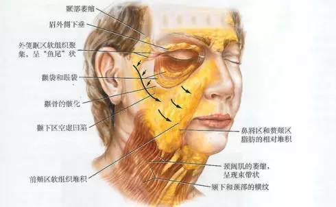 这个是我们脸部的脂肪分布图.