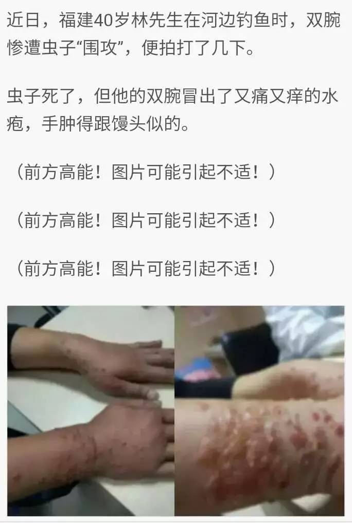 紧急隐形虫有剧毒别上当i