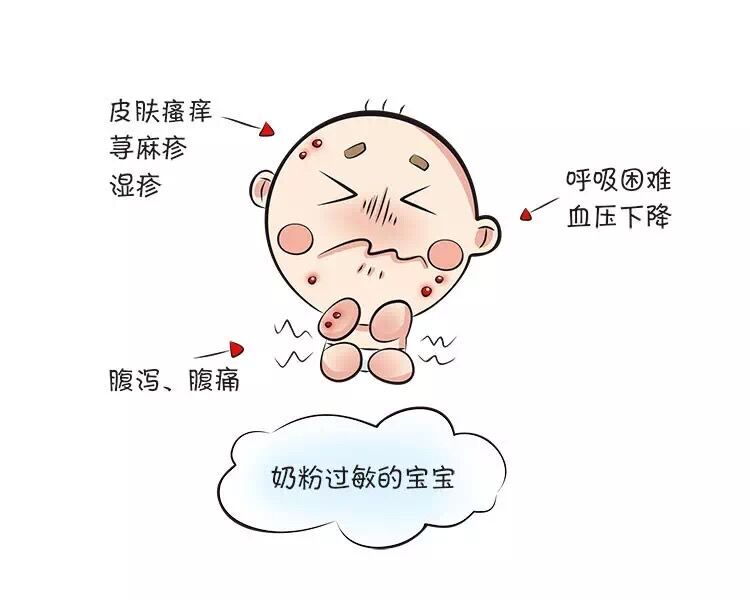 好端端的，宝宝怎么就奶粉过敏了呢？