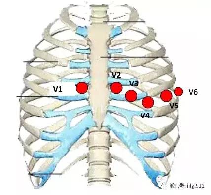 v2,胸骨左缘第4肋间. v3,v2与v4两点连线中点.