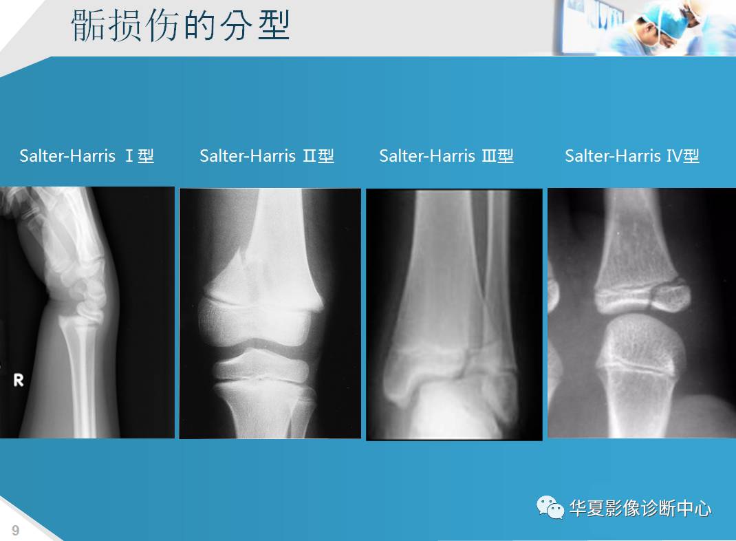 mri检查在骨骺损伤中的应用研研究与进展