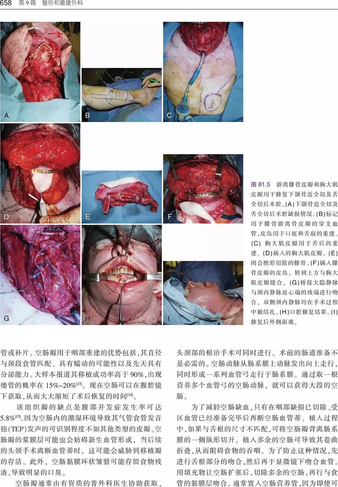 书讯:经典巨著《耳鼻咽喉头颈外科手术学(上下卷》隆重出版