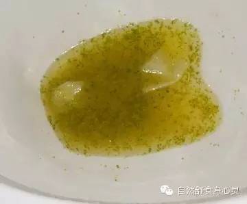 这都是一些胆结石的小颗粒.