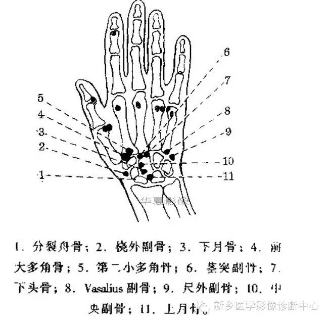 一副图包括了腕,踝关节常见副骨及解剖全部变异-不收藏一定后悔