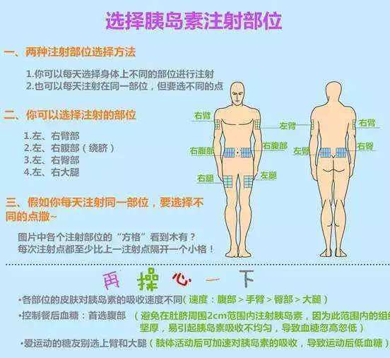 【合理用药】扎胰岛素我不怕不怕啦