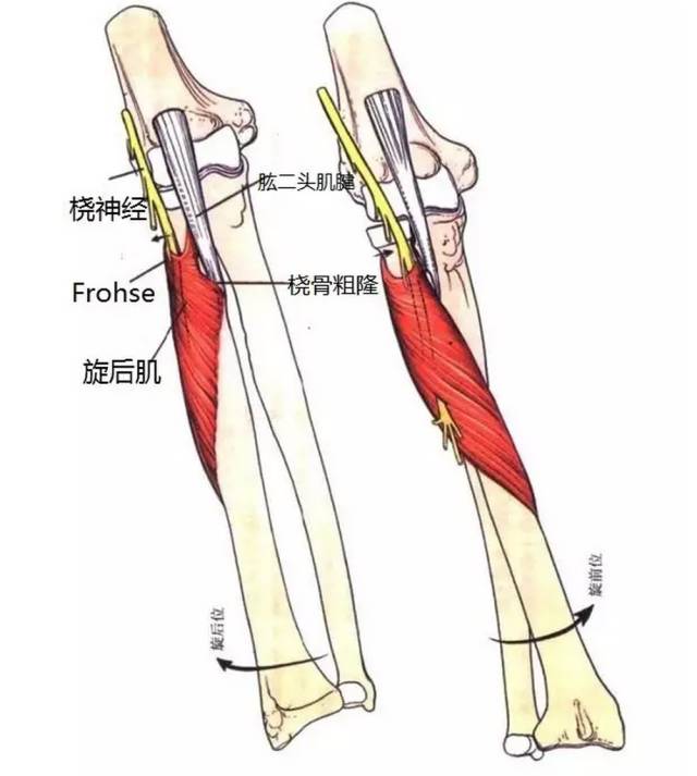 桡神经相关解剖和疾病