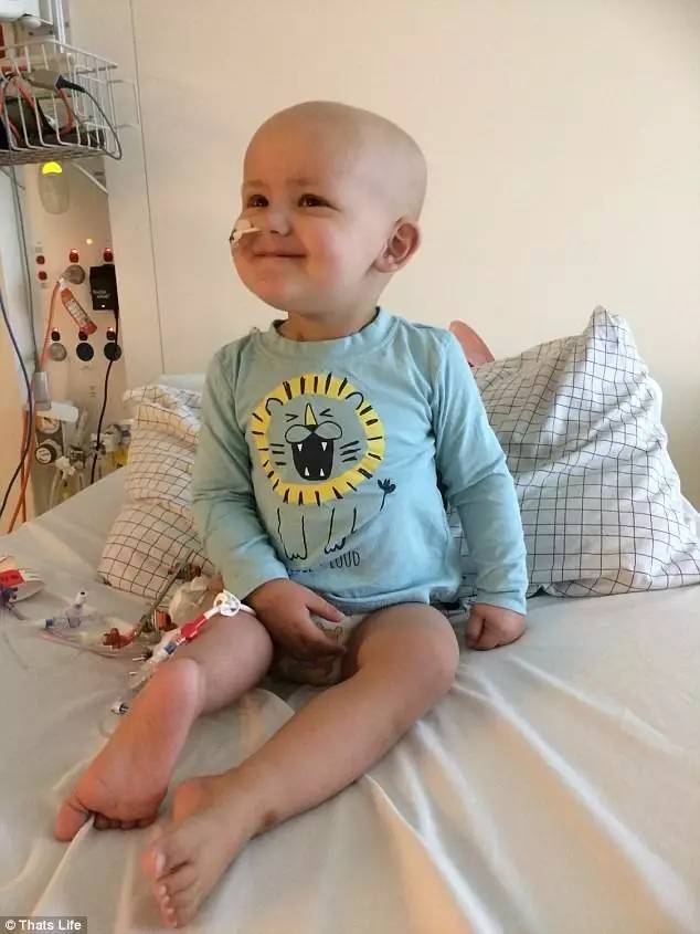 澳洲小男孩脚朝后手术成功治愈骨癌