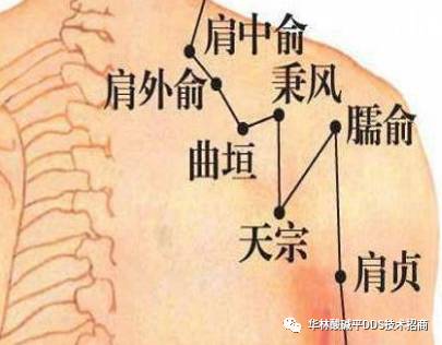 天宗穴是"乳腺增生"克星!