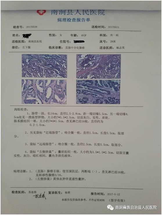 我院开展经腹直肠癌根治,吻合器保留肛门手术