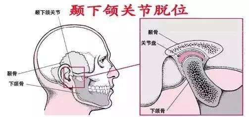 【解剖生理】 颞颌关节由下颌骨的一对髁状突(又称下颌小头)和颅底的