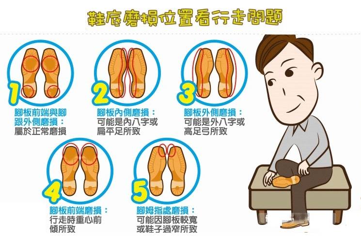 5种鞋底磨损类型:看出你走路姿势哪有问题?