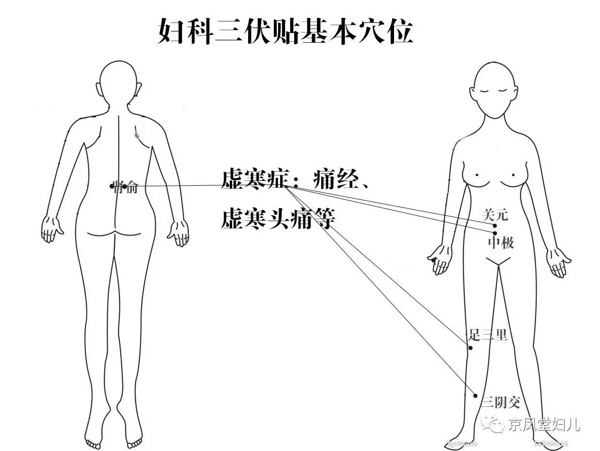 未病先防冬病夏治三伏贴