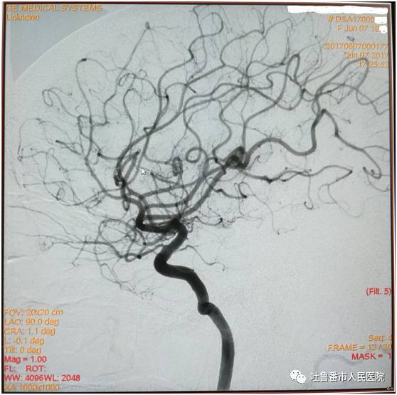 吐鲁番人口_吐鲁番葡萄