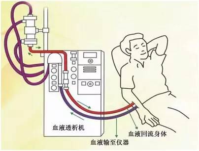 这天,由于肾衰竭我不得不在太仓市中医医院血液透析中心进行 第一次