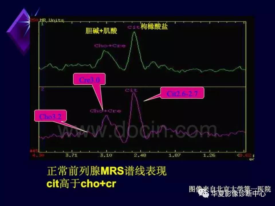 磁共振波谱分析(mrs)的应用