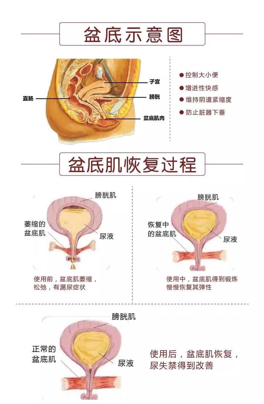 产后产后恢复得好不好看看盆底肌怎么说