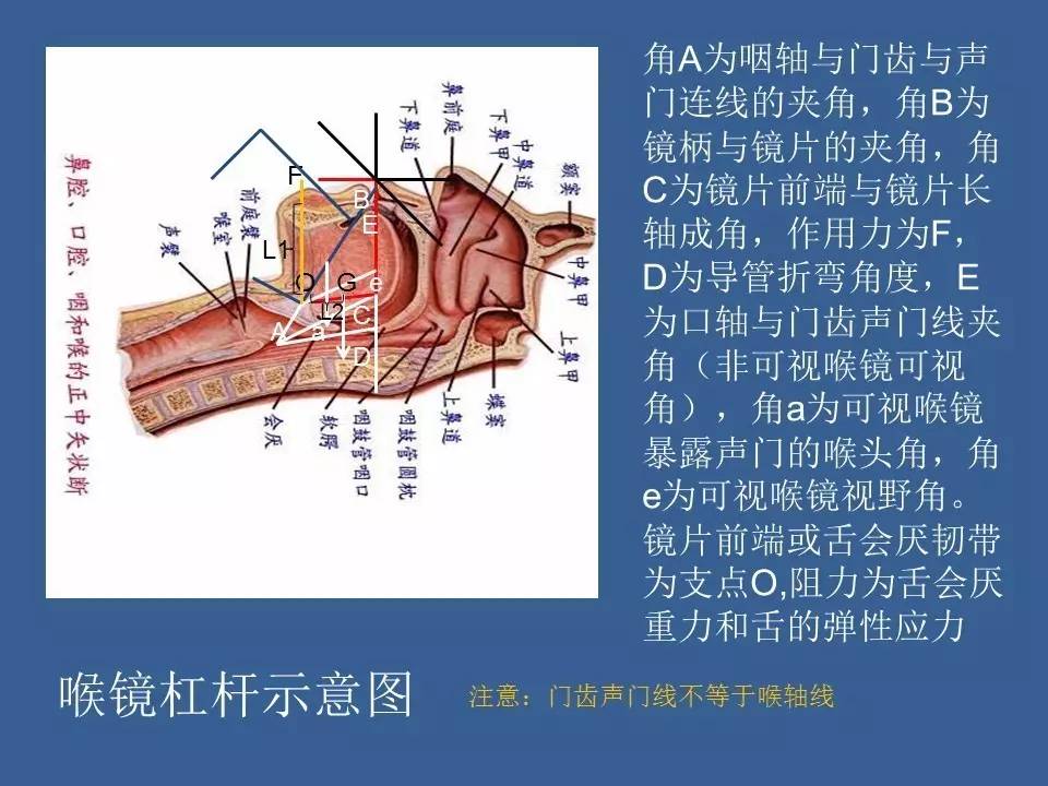 原创 基于杠杆原理的不同喉镜气管插管二维模型的创建与简易力学分析