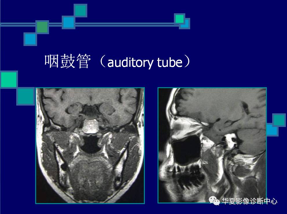 鼻咽与咽旁间隙的影像解剖