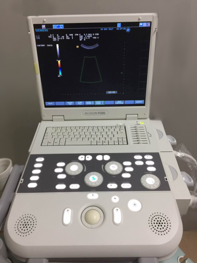 一台便携式b超的基础上,又新配备一台西门子acuson p300便携式彩超机