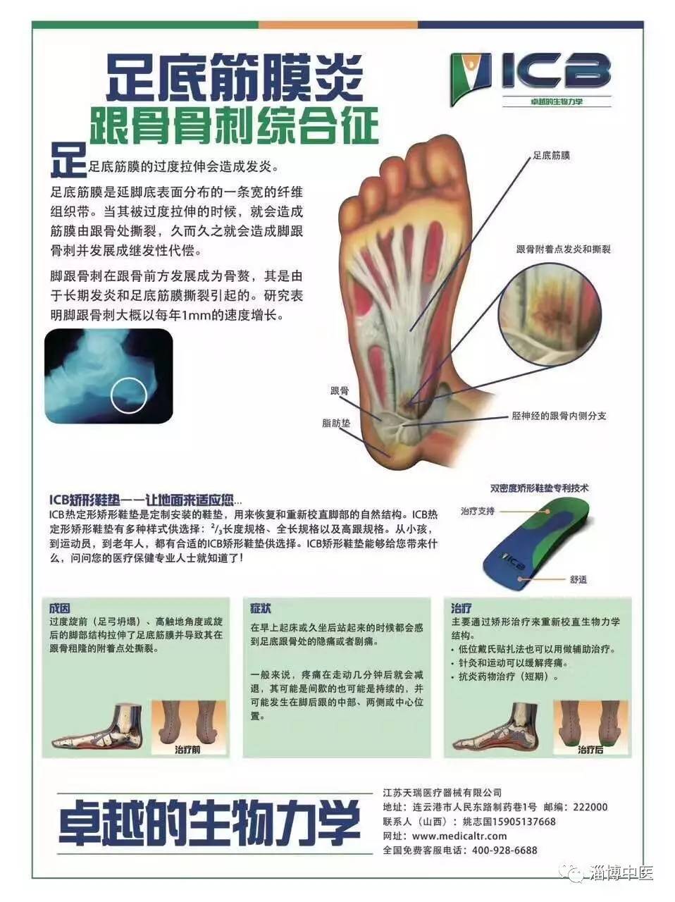 新技术淄博市中医医院举办icb生物力学矫形鞋垫制作新技术培训会