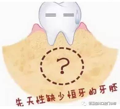 影响健康又毁容的"双排牙"你家宝宝有吗?