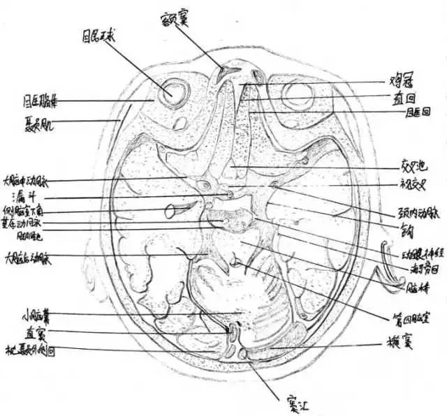 颅底内面观 严重车祸可能会导致颅内筛