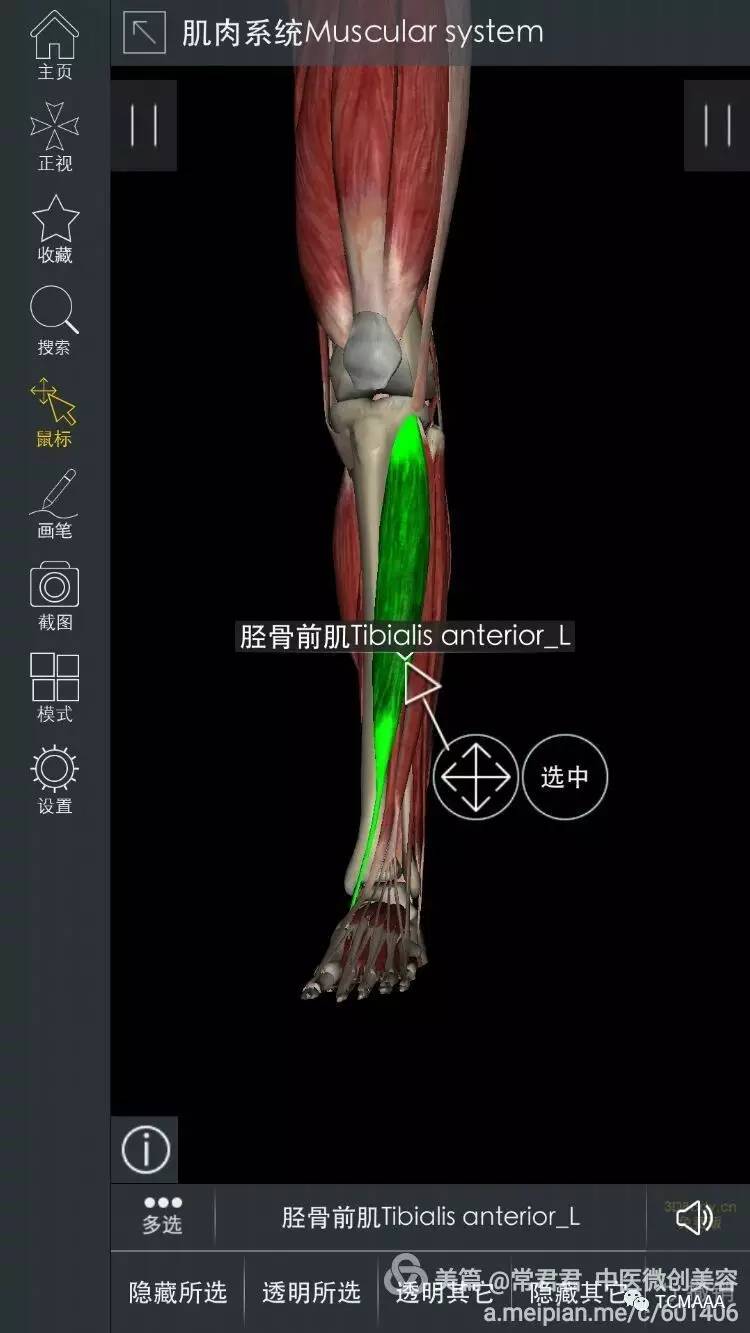 [病例讨论]运动损伤-胫骨前肌损伤