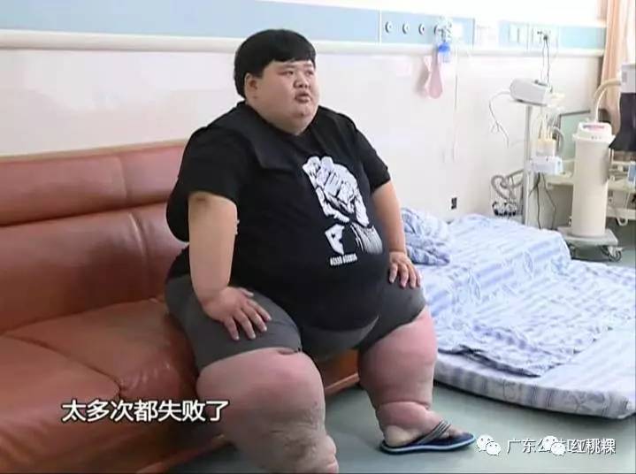 潮州27岁男子体重500斤,臀围2米